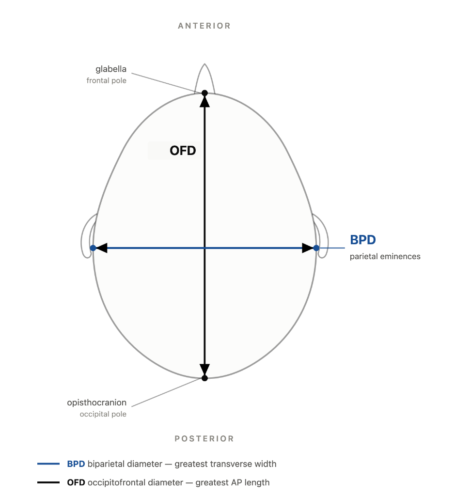 Cranial Index Diagram - Biparietal & Occipitofrontal Diameters
