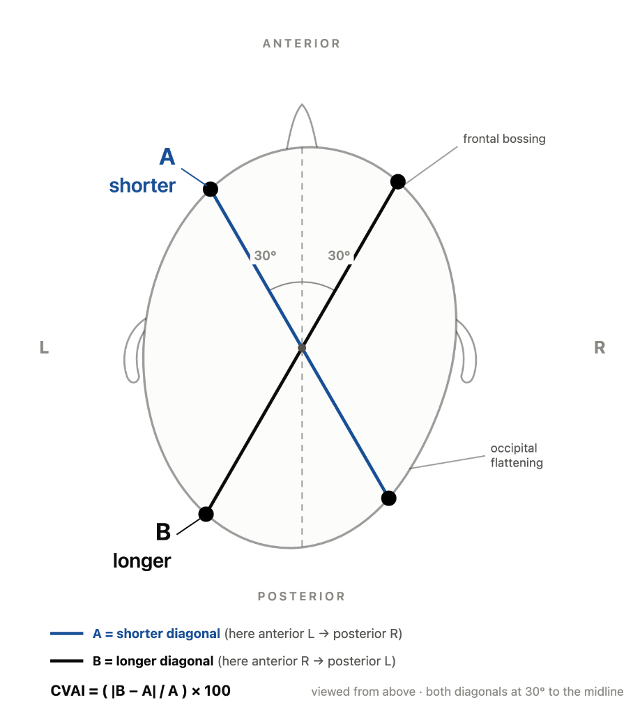 CVAI Diagonal Measurement Vertex View - 30 Degree Obliques